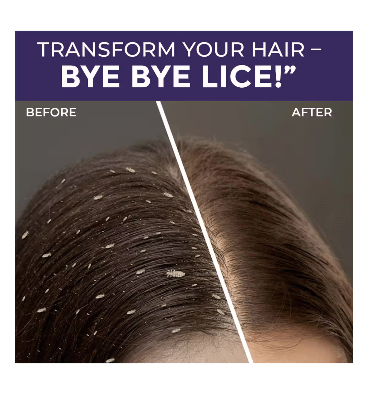 Herbal Anti-Lice & Nits Removal Combo | Natural Head Lice Treatment for Kids & Adults
