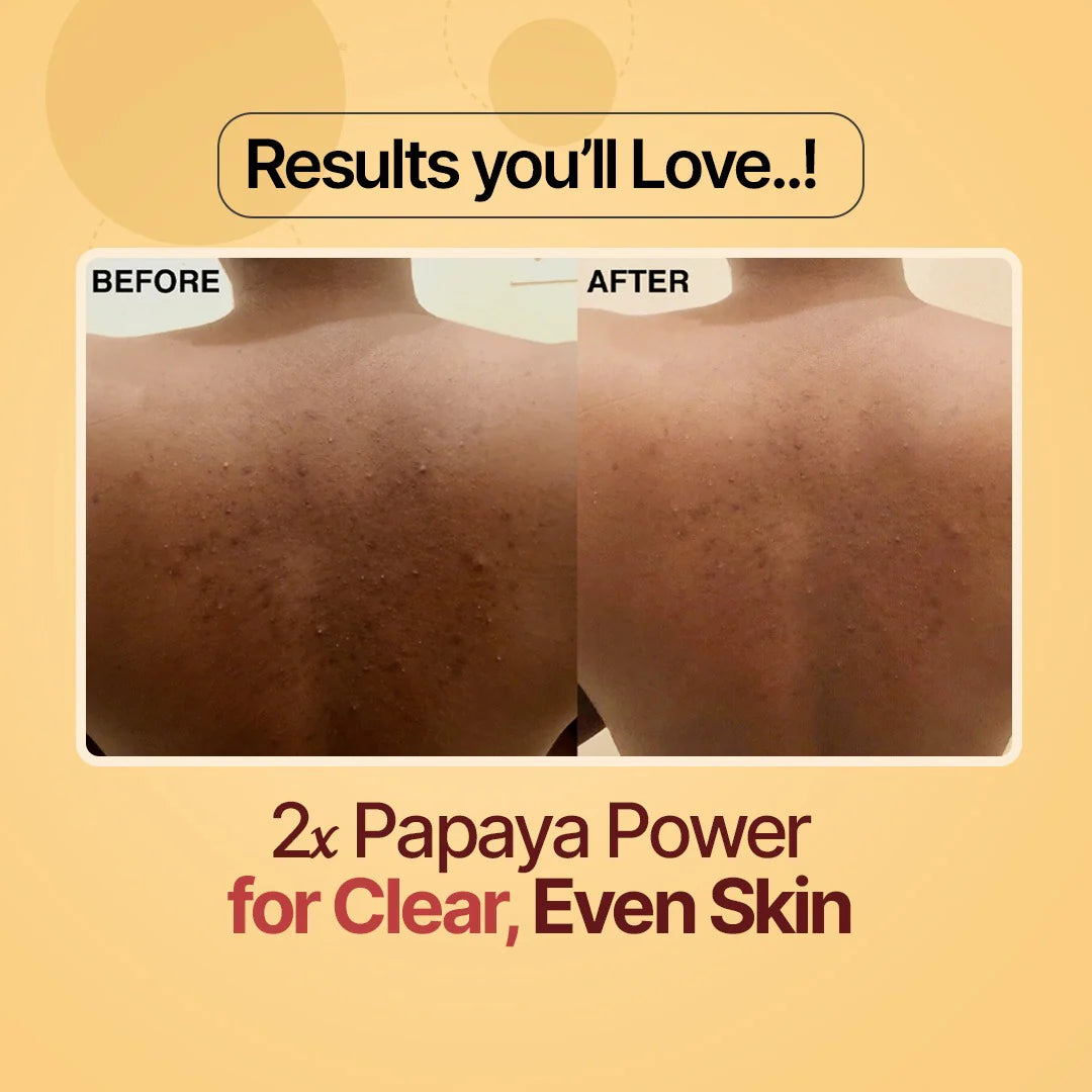 Youthface Papaya Beauty Bar