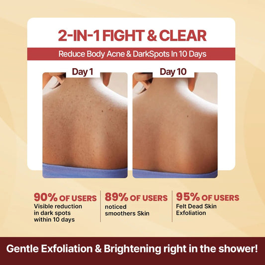 Advertisement for a dark spot remover soap showing before and after effects on skin with text highlighting user benefits.