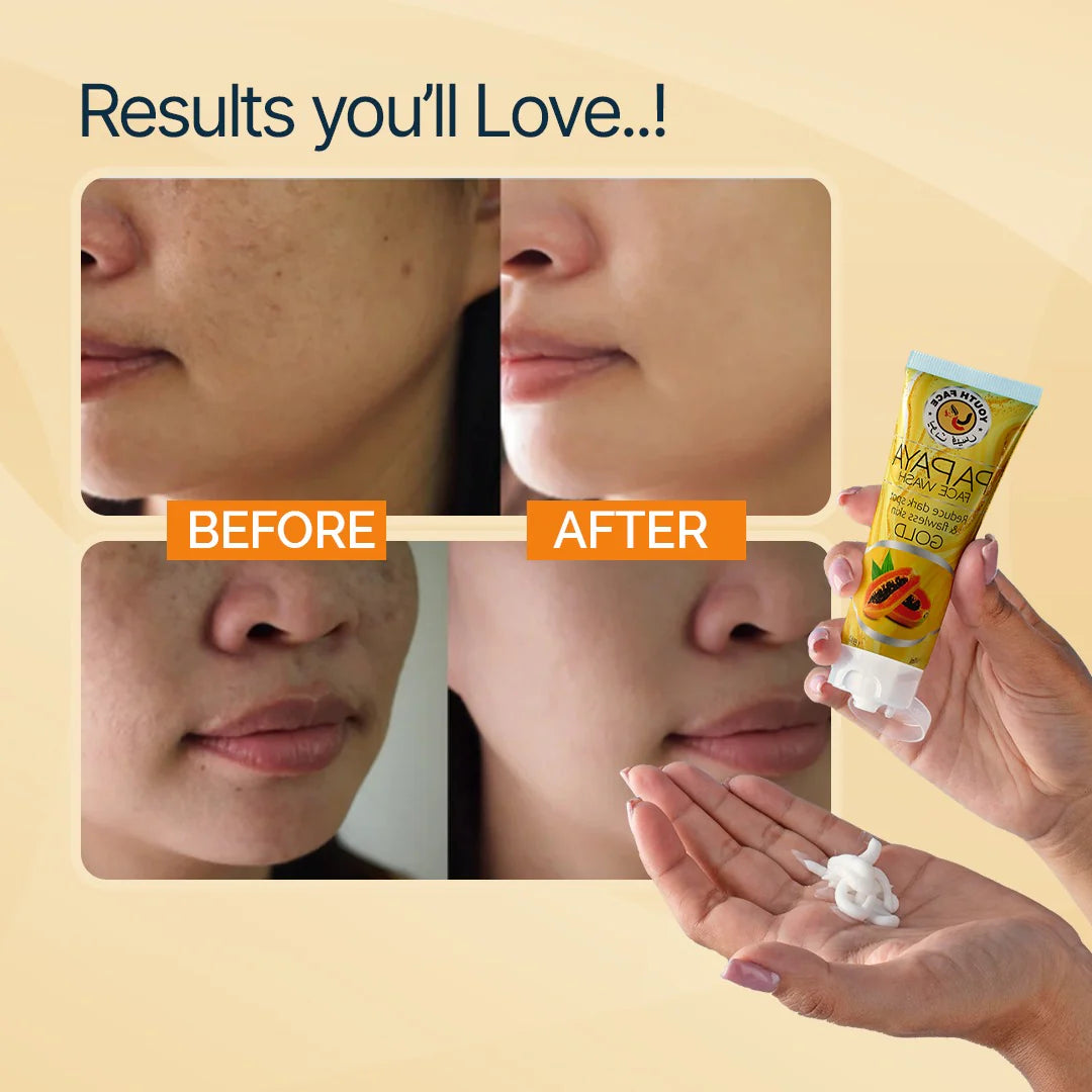 Before and after comparison of skin with a tube of Youthface Papaya Face Wash