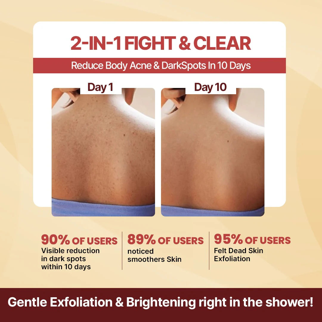Advertisement for a dark spot remover soap showing before and after effects on skin with text highlighting user benefits.
